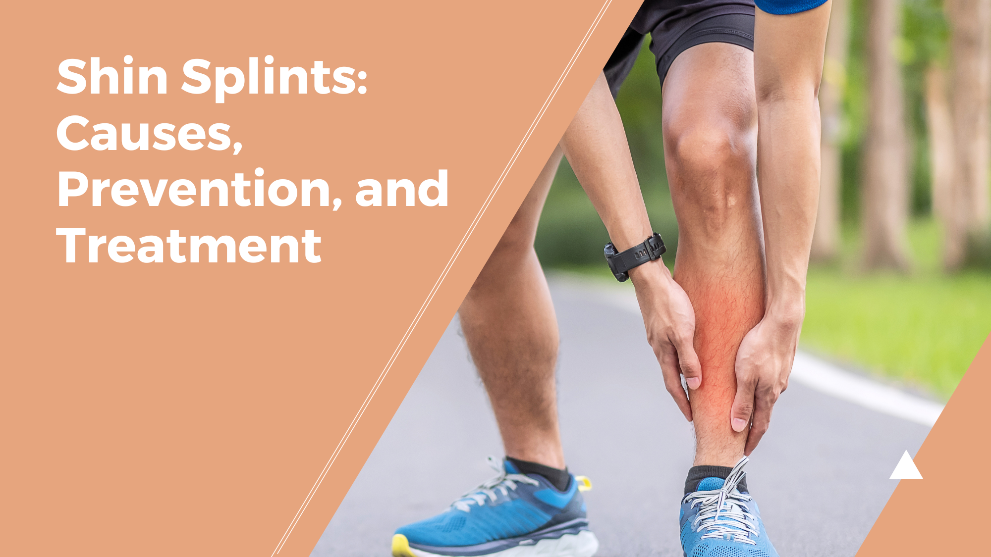 Shin Splints Causes Symptoms Treatment And Prevention 5845